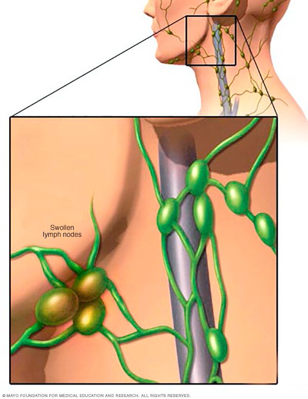 Where can a person find a picture of the lymph nodes in the groin?